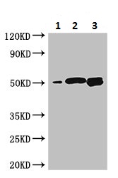 Western blot - Anti-BTNL2 antibody (AB223053), expandable thumbnail