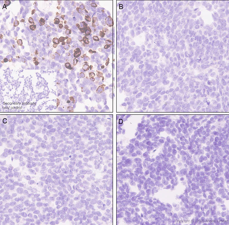 Immunohistochemistry (Formalin/PFA-fixed paraffin-embedded sections) - Anti-BTNL3 antibody [EPR30749-583] (AB324982)