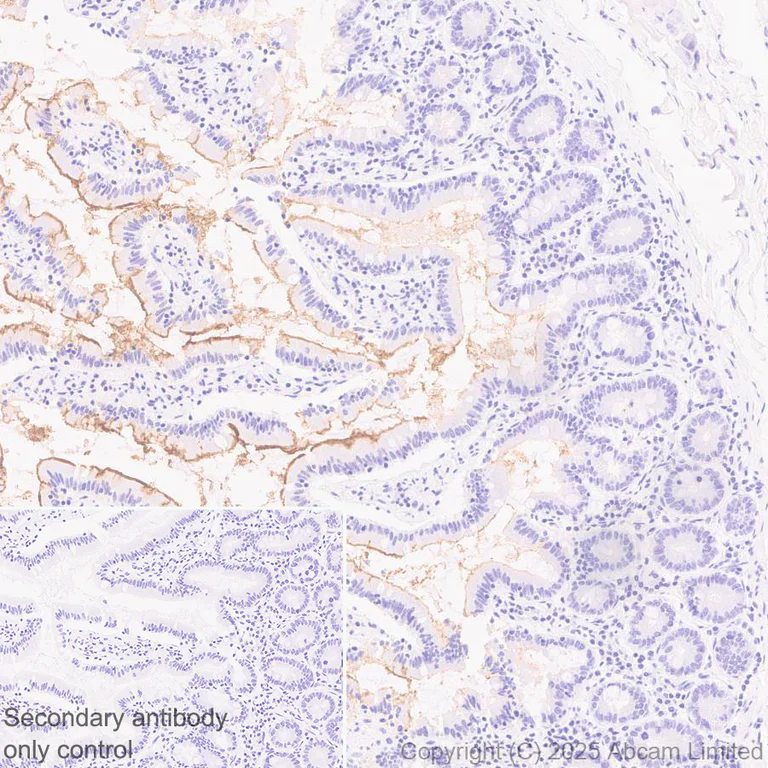 Immunohistochemistry (Formalin/PFA-fixed paraffin-embedded sections) - Anti-BTNL3 antibody [EPR30749-583] (AB324982)
