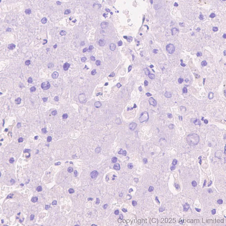 Immunohistochemistry (Formalin/PFA-fixed paraffin-embedded sections) - Anti-BTNL3 antibody [EPR30749-583] (AB324982)