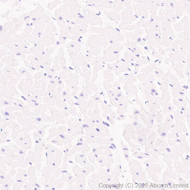 Immunohistochemistry (Formalin/PFA-fixed paraffin-embedded sections) - Anti-BTNL3 antibody [EPR30749-583] (AB324982)