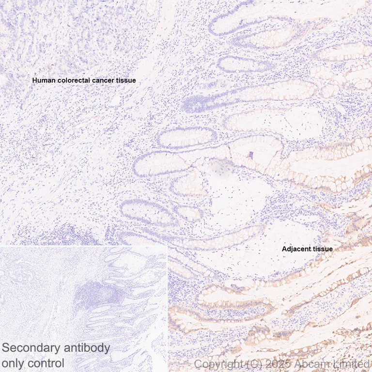Immunohistochemistry (Formalin/PFA-fixed paraffin-embedded sections) - Anti-BTNL8 antibody [EPR30750-591] (AB324522)