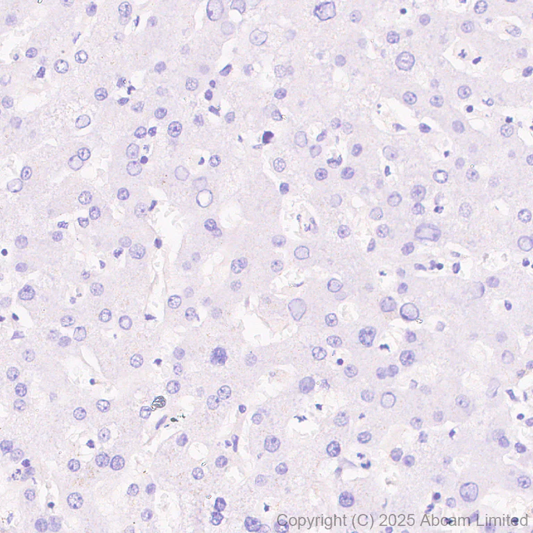 Immunohistochemistry (Formalin/PFA-fixed paraffin-embedded sections) - Anti-BTNL8 antibody [EPR30750-591] (AB324522)
