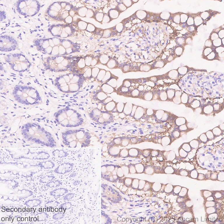 Immunohistochemistry (Formalin/PFA-fixed paraffin-embedded sections) - Anti-BTNL8 antibody [EPR30750-591] (AB324522)