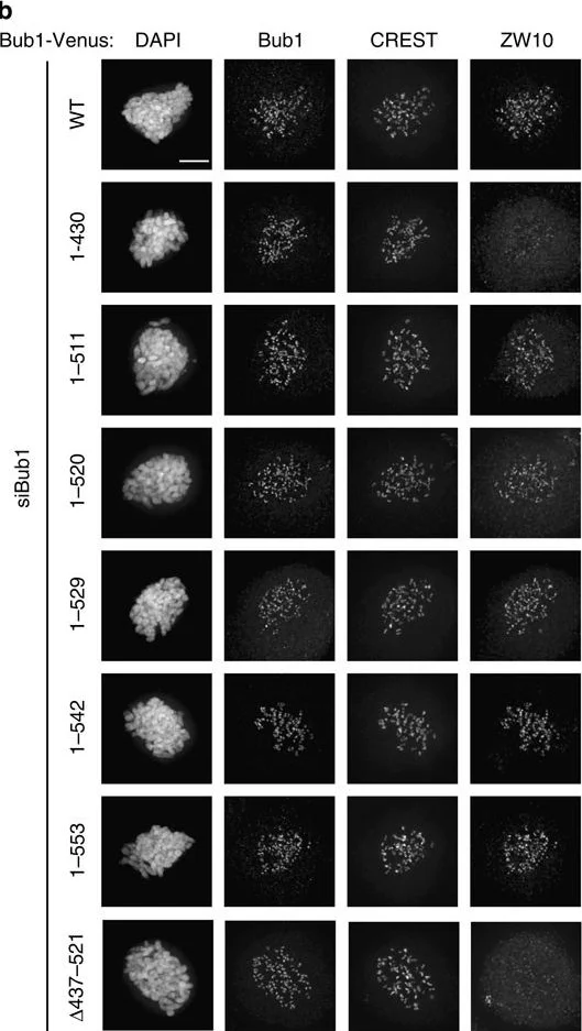 Immunocytochemistry/ Immunofluorescence - Anti-Bub1 antibody [2F9] (AB54893)