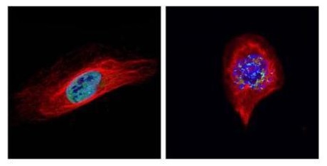 Immunocytochemistry/ Immunofluorescence - Anti-Bub1 antibody (AB227228), expandable thumbnail
