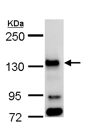 Western blot - Anti-Bub1 antibody (AB227228), expandable thumbnail