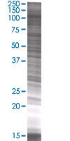 Bub1 overexpression 293T lysate (whole cell)