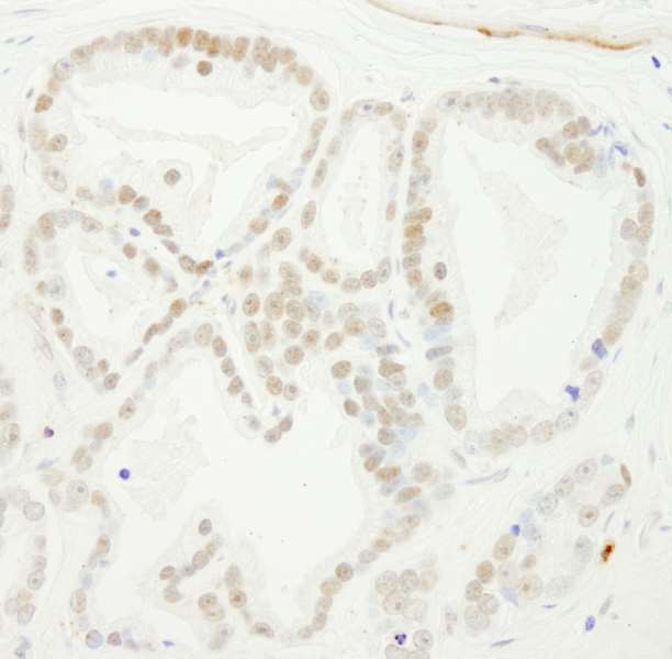 Immunohistochemistry (Formalin/PFA-fixed paraffin-embedded sections) - Anti-Bub3 antibody (AB264121), expandable thumbnail