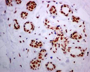 Immunohistochemistry (Formalin/PFA-fixed paraffin-embedded sections) - Anti-Bub3 antibody [EPR5319(2)] (AB133699)