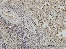 Immunohistochemistry (Formalin/PFA-fixed paraffin-embedded sections) - Anti-BubR1 antibody [2G5] (AB54894)