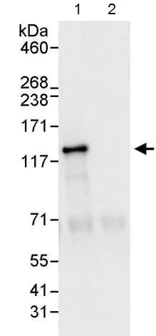 Immunoprecipitation - Anti-BubR1 antibody (AB215351)