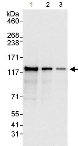 Western blot - Anti-BubR1 antibody (AB215351)