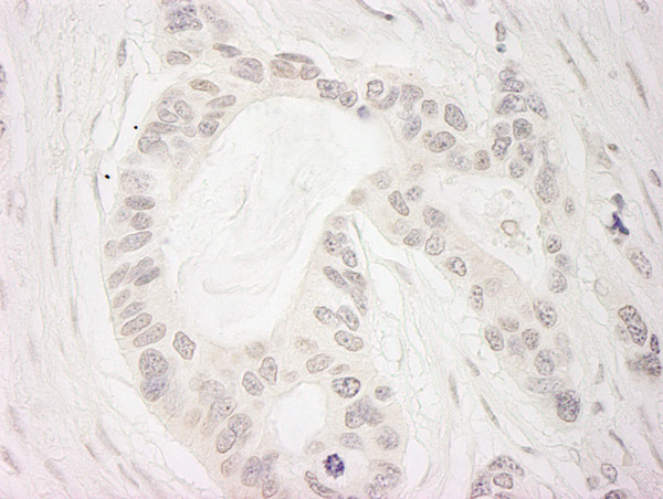 Immunohistochemistry (Formalin/PFA-fixed paraffin-embedded sections) - Anti-BubR1 antibody (AB70544)