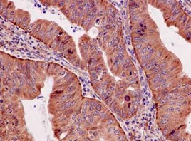 Immunohistochemistry (Formalin/PFA-fixed paraffin-embedded sections) - Anti-BubR1 antibody [EPR12259(2)] (AB183496)