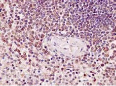 Immunohistochemistry (Formalin/PFA-fixed paraffin-embedded sections) - Anti-BubR1 antibody [EPR12259(2)] (AB183496)