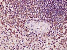 Immunohistochemistry (Formalin/PFA-fixed paraffin-embedded sections) - Anti-BubR1 antibody [EPR12259(2)] - BSA and Azide free (AB250655)