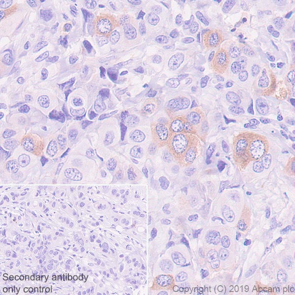 Immunohistochemistry (Formalin/PFA-fixed paraffin-embedded sections) - Anti-BubR1 antibody [EPR22544-48] (AB254326)