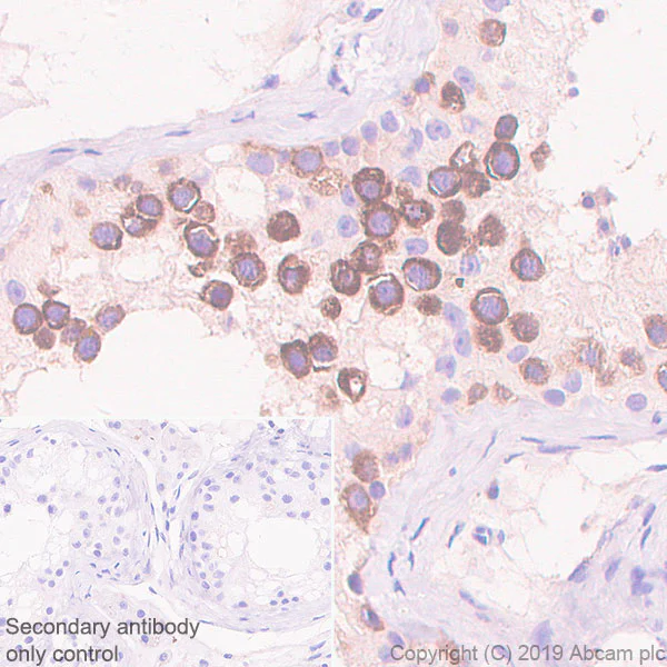 Immunohistochemistry (Formalin/PFA-fixed paraffin-embedded sections) - Anti-BubR1 antibody [EPR22544-48] - BSA and Azide free (AB255249)