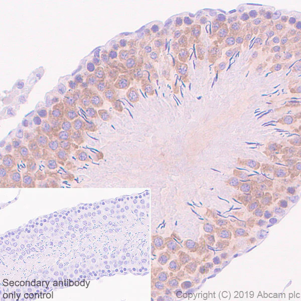 Immunohistochemistry (Formalin/PFA-fixed paraffin-embedded sections) - Anti-BubR1 antibody [EPR22544-48] - BSA and Azide free (AB255249)