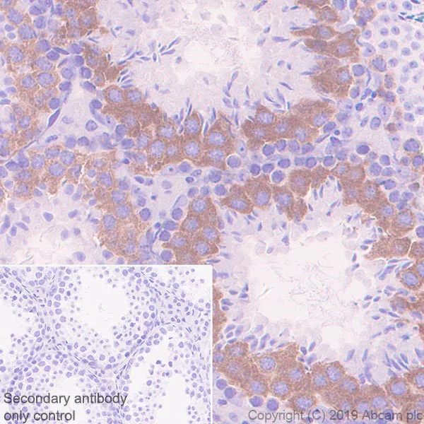 Immunohistochemistry (Formalin/PFA-fixed paraffin-embedded sections) - Anti-BubR1 antibody [EPR22544-48] - BSA and Azide free (AB255249)