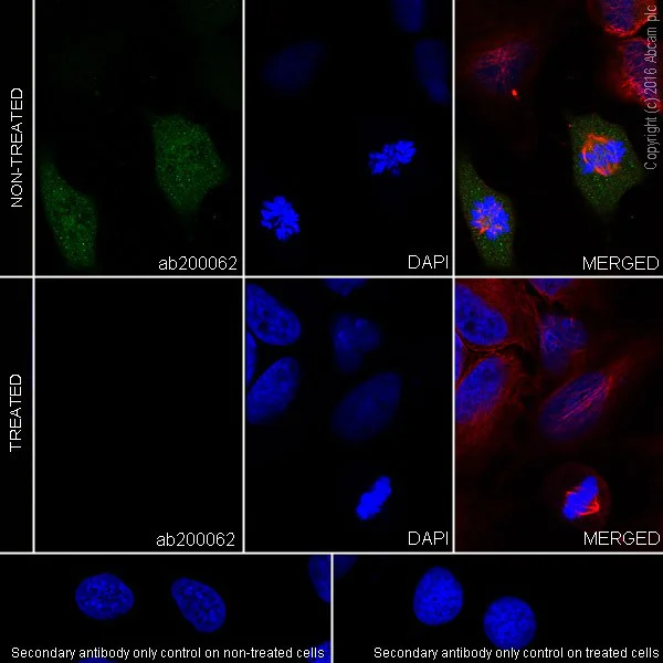Immunocytochemistry/ Immunofluorescence - Anti-BubR1 (phospho S670) antibody [EPR20109] (AB200062)