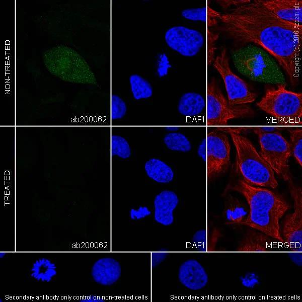 Immunocytochemistry/ Immunofluorescence - Anti-BubR1 (phospho S670) antibody [EPR20109] (AB200062)