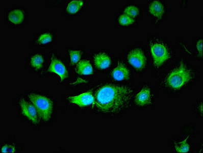 Immunocytochemistry/ Immunofluorescence - Anti-BUD31 antibody (AB237493), expandable thumbnail