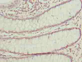 Immunohistochemistry (Formalin/PFA-fixed paraffin-embedded sections) - Anti-BUD31 antibody (AB237493)