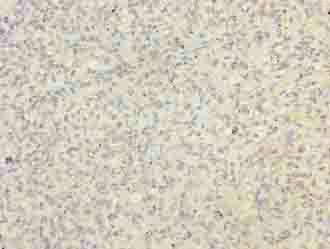 Immunohistochemistry (Formalin/PFA-fixed paraffin-embedded sections) - Anti-BUD31 antibody (AB237493), expandable thumbnail