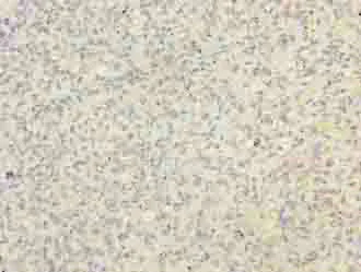 Immunohistochemistry (Formalin/PFA-fixed paraffin-embedded sections) - Anti-BUD31 antibody (AB237493)