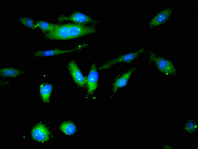 Immunocytochemistry/ Immunofluorescence - Anti-Butyrylcholinesterase antibody (AB236577), expandable thumbnail