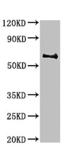 Western blot - Anti-Butyrylcholinesterase antibody (AB236577)