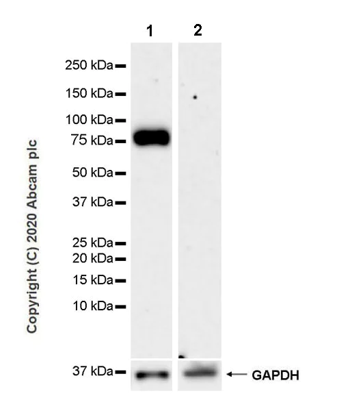 Western blot - Anti-Butyrylcholinesterase antibody [EPR23792-163] - BSA and Azide free (AB274382)