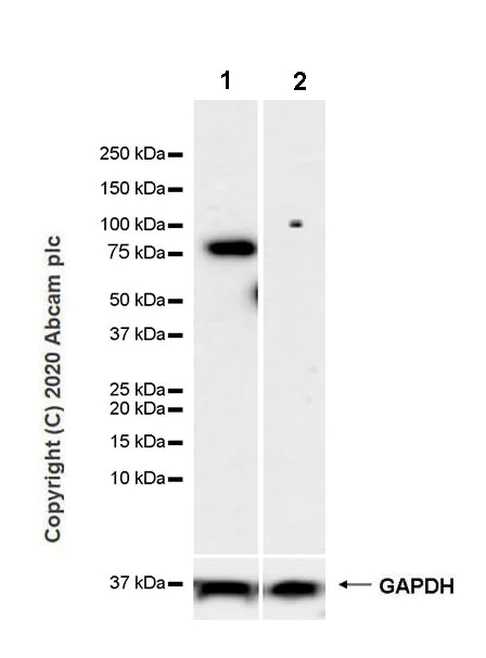 Western blot - Anti-Butyrylcholinesterase antibody [EPR23792-163] - BSA and Azide free (AB274382)