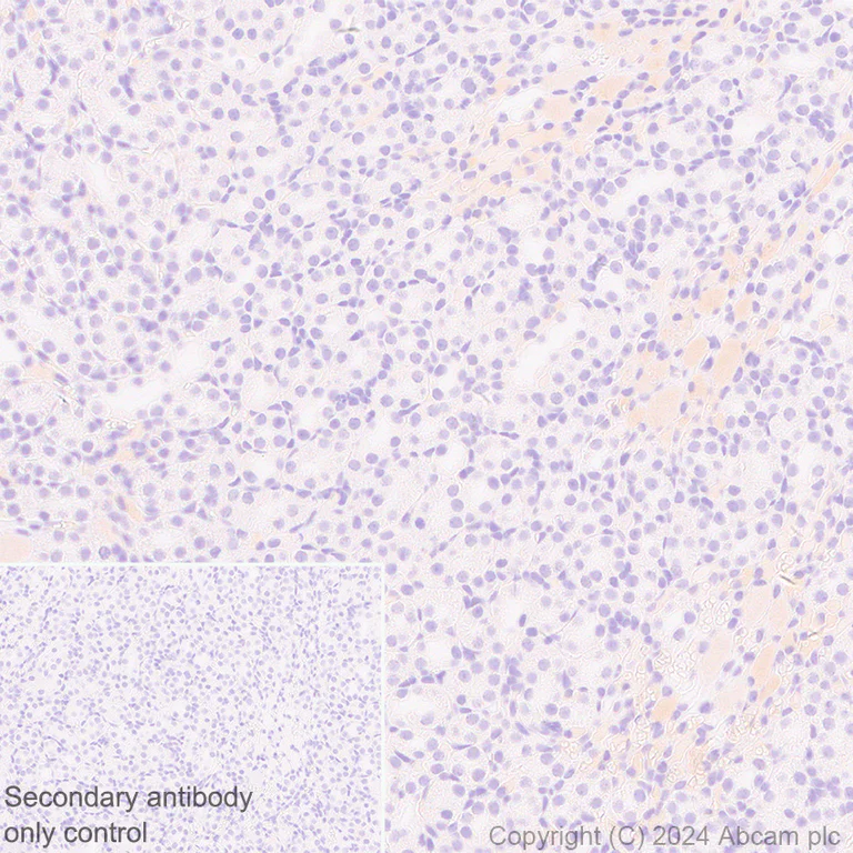 Immunohistochemistry (Formalin/PFA-fixed paraffin-embedded sections) - Anti-Butyrylcholinesterase antibody [EPR26630-54] (AB317016)