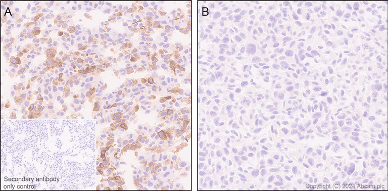 Immunohistochemistry (Formalin/PFA-fixed paraffin-embedded sections) - Anti-Butyrylcholinesterase antibody [EPR26630-54] (AB317016)
