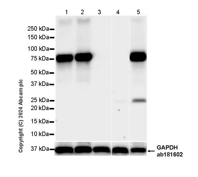 Western blot - Anti-Butyrylcholinesterase antibody [EPR26630-54] (AB317016)