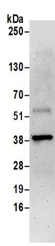 Immunoprecipitation - Anti-BVR antibody (AB192925)