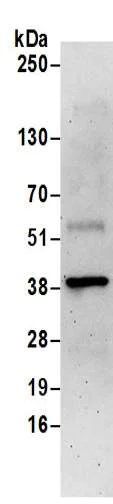 Immunoprecipitation - Anti-BVR antibody (AB192925)