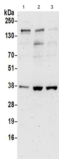 Western blot - Anti-BVR antibody (AB192925)