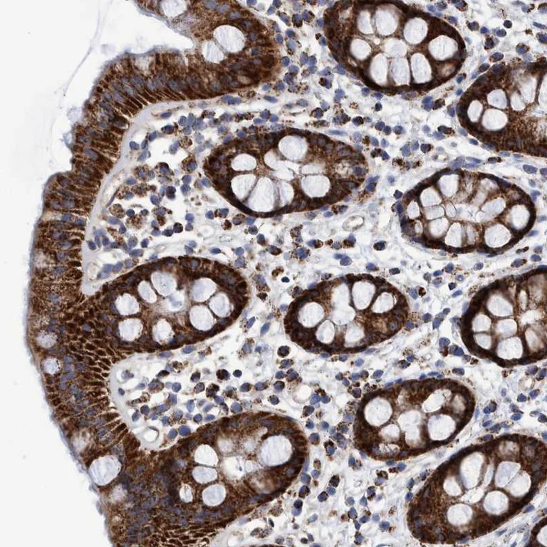 Immunohistochemistry (Formalin/PFA-fixed paraffin-embedded sections) - Anti-BZW2 antibody (AB254771)
