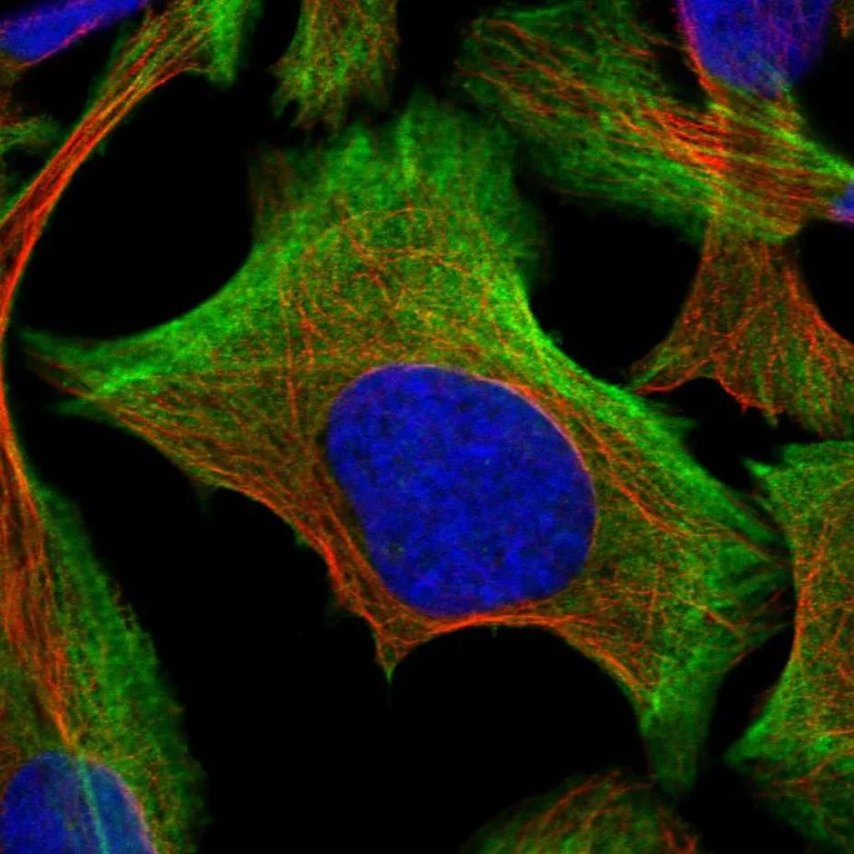 Immunocytochemistry/ Immunofluorescence - Anti-BZW2 antibody (AB254772)