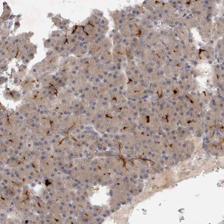 Immunohistochemistry (Formalin/PFA-fixed paraffin-embedded sections) - Anti-BZW2 antibody (AB254772)