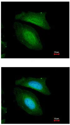 Immunocytochemistry/ Immunofluorescence - Anti-BZW2 antibody (AB96682)