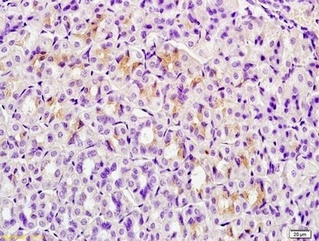 Immunohistochemistry (Formalin/PFA-fixed paraffin-embedded sections) - Anti-C-4 Methylsterol Oxidase/SC4MOL antibody (AB203587)