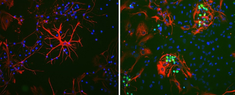Immunocytochemistry/ Immunofluorescence - Anti-c-Fos antibody [2H2] (AB208942), expandable thumbnail