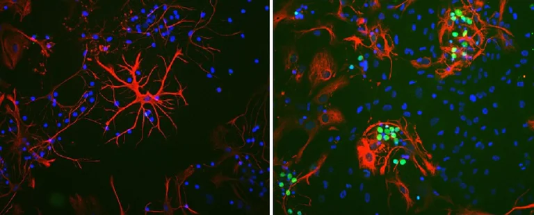 Immunocytochemistry/ Immunofluorescence - Anti-c-Fos antibody [2H2] (AB208942)