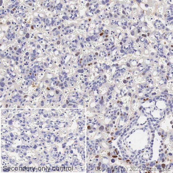 Immunohistochemistry (Formalin/PFA-fixed paraffin-embedded sections) - Anti-c-Fos antibody [2H2] (ab208942), expandable thumbnail