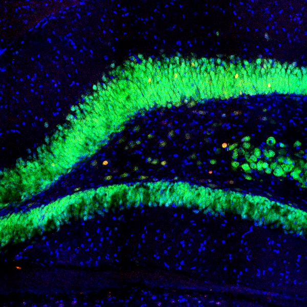Immunohistochemistry - Free Floating - Anti-c-Fos antibody [2H2] (AB208942), expandable thumbnail
